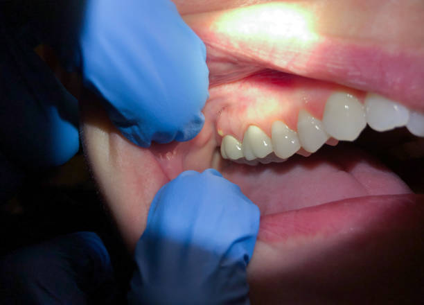 Best Orthodontic Emergency Dentist in Seth Ward, TX